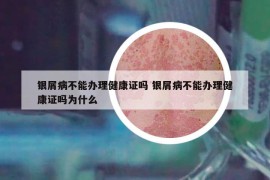 銀屑病不能辦理健康證嗎 銀屑病不能辦理健康證嗎為什么