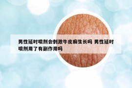 男性延時噴劑會刺激牛皮癬生長嗎 男性延時噴劑用了有副作用嗎