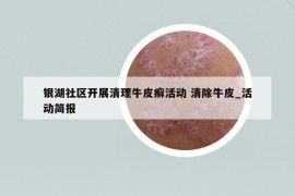 銀湖社區(qū)開展清理牛皮癬活動 清除牛皮_活動簡報