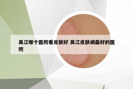 吳江哪個(gè)醫(yī)院看皮膚好 吳江皮膚病最好的醫(yī)院