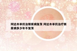 阿達(dá)木單抗治銀屑病復(fù)發(fā) 阿達(dá)木單抗治療銀屑病多少年不復(fù)發(fā)
