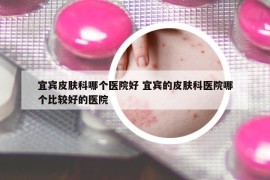 宜賓皮膚科哪個(gè)醫(yī)院好 宜賓的皮膚科醫(yī)院哪個(gè)比較好的醫(yī)院