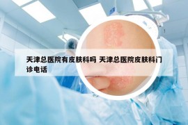 天津總醫(yī)院有皮膚科嗎 天津總醫(yī)院皮膚科門診電話