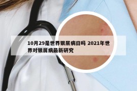 10月29是世界銀屑病日嗎 2021年世界對(duì)銀屑病最新研究