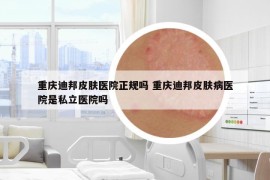 重慶迪邦皮膚醫(yī)院正規(guī)嗎 重慶迪邦皮膚病醫(yī)院是私立醫(yī)院嗎