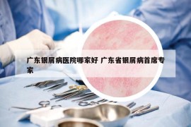 廣東銀屑病醫(yī)院哪家好 廣東省銀屑病首席專家