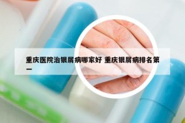 重慶醫(yī)院治銀屑病哪家好 重慶銀屑病排名第一