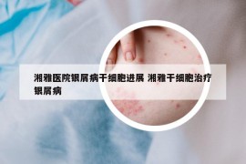 湘雅醫(yī)院銀屑病干細胞進展 湘雅干細胞治療銀屑病