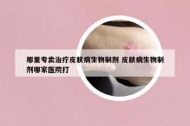 那里專賣治療皮膚病生物制劑 皮膚病生物制劑哪家醫(yī)院打