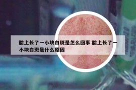臉上長(zhǎng)了一小塊白斑是怎么回事 臉上長(zhǎng)了一小塊白斑是什么原因