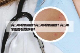 商丘哪看銀屑病好商丘哪看銀屑病好 商丘哪家醫(yī)院看皮膚科好