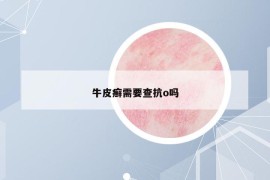 牛皮癬需要查抗o嗎