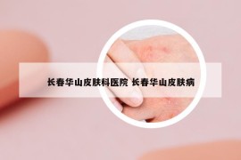 長(zhǎng)春華山皮膚科醫(yī)院 長(zhǎng)春華山皮膚病