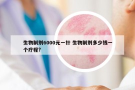 生物制劑6000元一針 生物制劑多少錢(qián)一個(gè)療程?