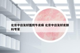 北京中日友好醫(yī)院牛皮癬 北京中日友好皮膚科專(zhuān)家