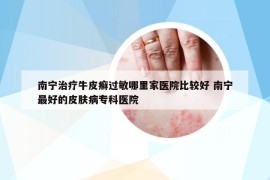 南寧治療牛皮癬過敏哪里家醫(yī)院比較好 南寧最好的皮膚病?？漆t(yī)院