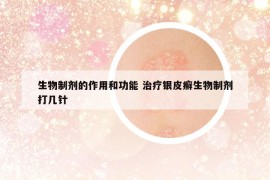 生物制劑的作用和功能 治療銀皮癬生物制劑打幾針
