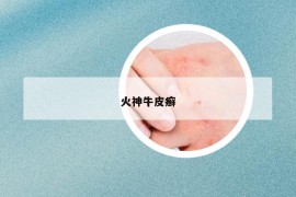 火神牛皮癬