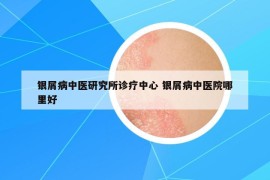 銀屑病中醫(yī)研究所診療中心 銀屑病中醫(yī)院哪里好