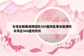 石家莊聯(lián)勤保障部隊(duì)980醫(yī)院能看皮膚病嗎 石家莊980醫(yī)院院長(zhǎng)