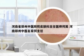 河南省鄭州中醫(yī)附院皮膚科主任醫(yī)師何英 河南鄭州中醫(yī)名家何主任