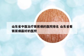 山東省中醫(yī)治療銀屑病的醫(yī)院排名 山東省看銀屑病最好的醫(yī)院
