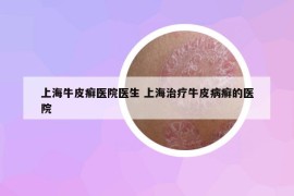 上海牛皮癬醫(yī)院醫(yī)生 上海治療牛皮病癬的醫(yī)院