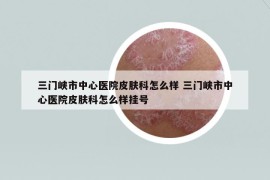 三門峽市中心醫(yī)院皮膚科怎么樣 三門峽市中心醫(yī)院皮膚科怎么樣掛號