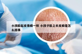 小孩臉起皮像癬一樣 小孩子臉上長(zhǎng)皮癬是怎么回事