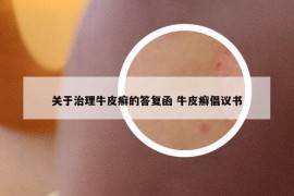 關于治理牛皮癬的答復函 牛皮癬倡議書