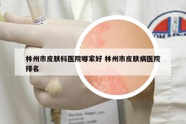 林州市皮膚科醫(yī)院哪家好 林州市皮膚病醫(yī)院排名
