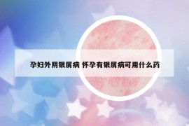 孕婦外陰銀屑病 懷孕有銀屑病可用什么藥