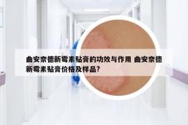 曲安奈德新霉素貼膏的功效與作用 曲安奈德新霉素貼膏價(jià)格及樣品?