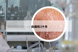 白癜風(fēng)3個月