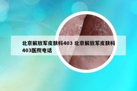 北京解放軍皮膚科403 北京解放軍皮膚科403醫(yī)院電話