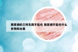 銀屑病的三樣?xùn)|西不能吃 銀屑病不能吃什么食物和水果