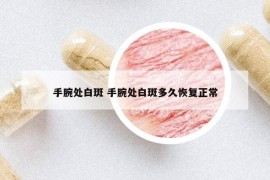 手腕處白斑 手腕處白斑多久恢復(fù)正常