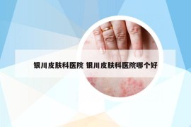 銀川皮膚科醫(yī)院 銀川皮膚科醫(yī)院哪個好