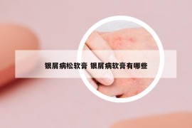 銀屑病松軟膏 銀屑病軟膏有哪些