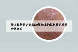臉上紅色胎記能去除嗎 臉上的紅色胎記后期會惡化嗎