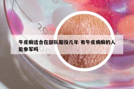 牛皮癬適合在部隊(duì)服役幾年 有牛皮病癬的人能參軍嗎