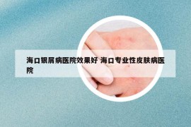?？阢y屑病醫(yī)院效果好 ?？趯I(yè)性皮膚病醫(yī)院