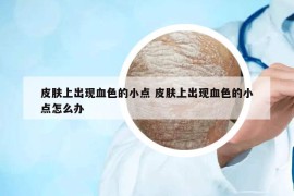 皮膚上出現(xiàn)血色的小點 皮膚上出現(xiàn)血色的小點怎么辦
