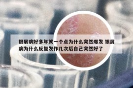 銀屑病好多年就一個(gè)點(diǎn)為什么突然爆發(fā) 銀屑病為什么反復(fù)發(fā)作幾次后自己突然好了