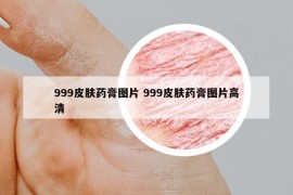 999皮膚藥膏圖片 999皮膚藥膏圖片高清
