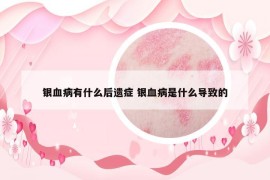 銀血病有什么后遺癥 銀血病是什么導(dǎo)致的