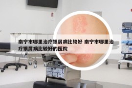 南寧市哪里治療銀屑病比較好 南寧市哪里治療銀屑病比較好的醫(yī)院