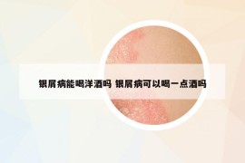 銀屑病能喝洋酒嗎 銀屑病可以喝一點酒嗎