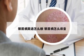 銀屑病英語怎么順 銀屑病怎么讀音