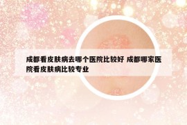 成都看皮膚病去哪個(gè)醫(yī)院比較好 成都哪家醫(yī)院看皮膚病比較專業(yè)